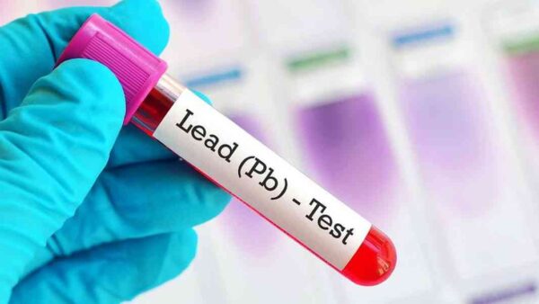 آزمایش سرب pb