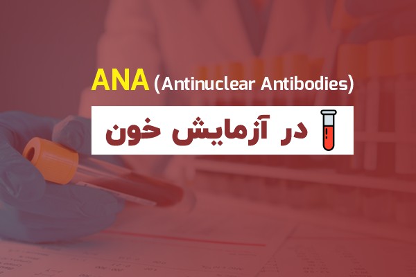 تست ANA چیست ؟