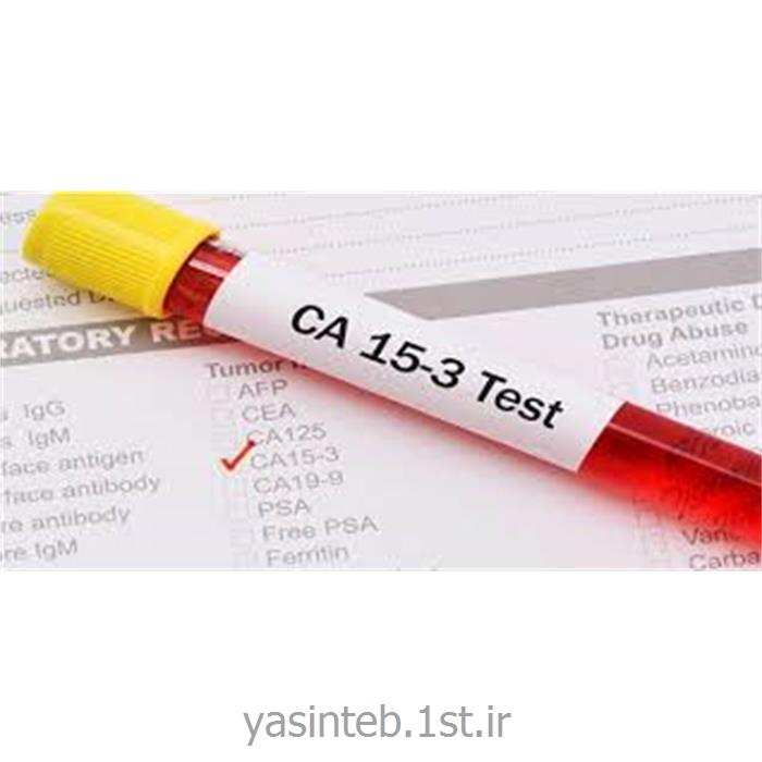 CA15-3 چیست ؟