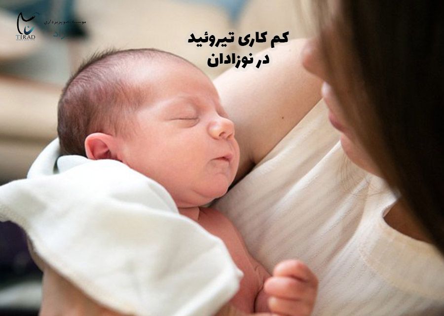 تیروئید در نوزادان
