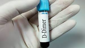 آزمایش D-Dimer 