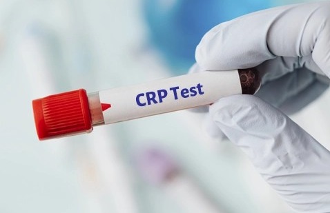 آزمایش CRP