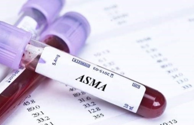 آزمایش ASMA