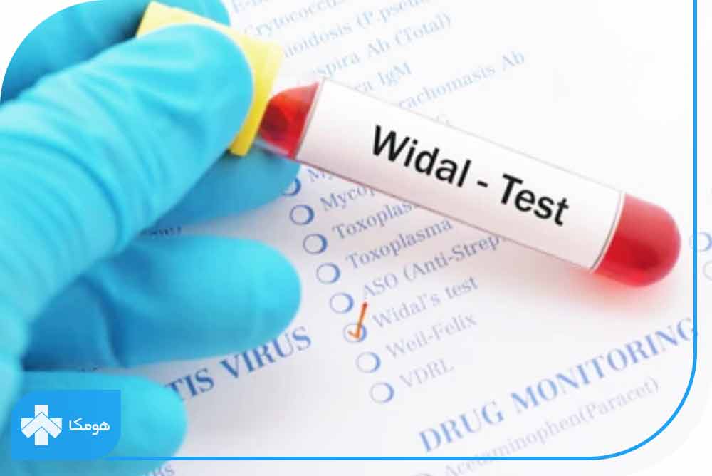 تست WIDALچیست؟