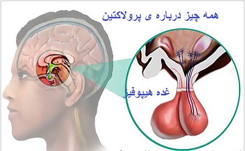 آزمایش پرولاکتین چیست ؟