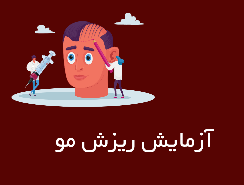 آزمایشات مرتبط به ریزش مو
