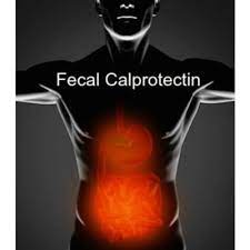 Calprotectinمارکر التهابی روده