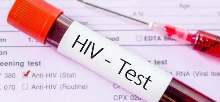 انواع آزمایشات تشخیصی برای عفونت HIV
